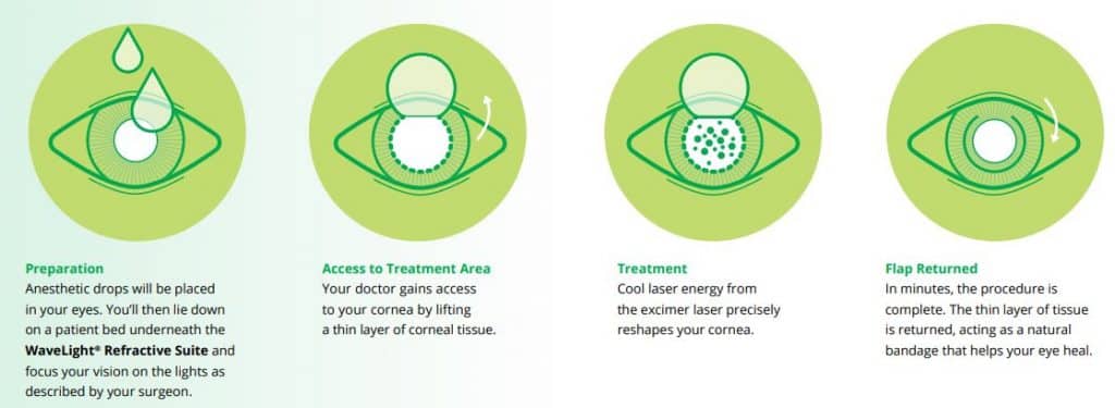 Best Lasik Surgery In Baton Rouge Louisiana Best Lasik Surgery In Baton Rouge Louisiana