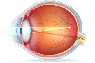 Best Lasik Surgery In Salt Lake City Utah Best Lasik Surgery In Salt Lake City Utah