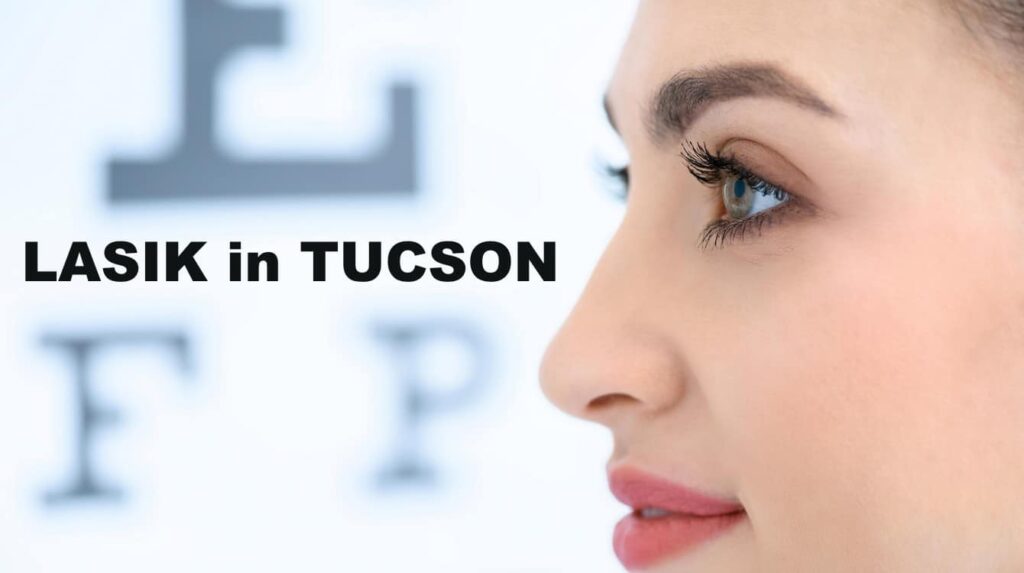 Best Lasik Surgery In Tucson Arizona