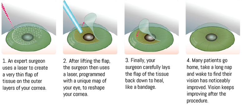 Best Lasik Surgery In Tulsa Oklahoma Best Lasik Surgery In Tulsa Oklahoma