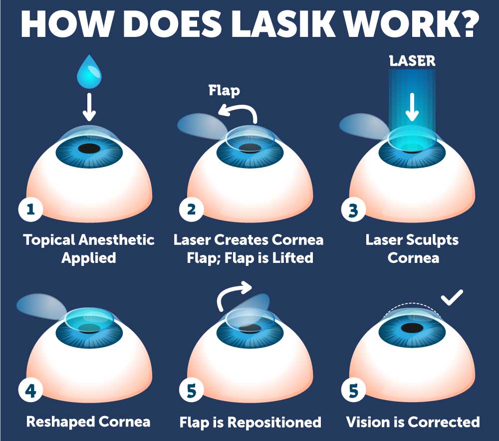 Is LASIK a painful procedure?