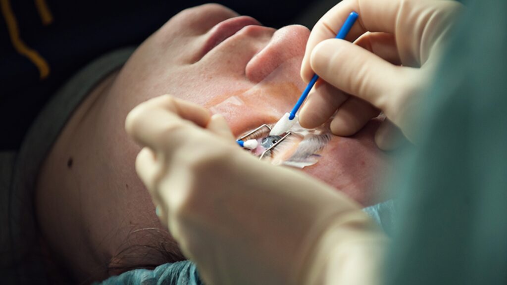 Is Lasik Surgery Safe?