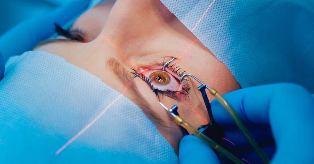 Is Lasik Surgery Safe?