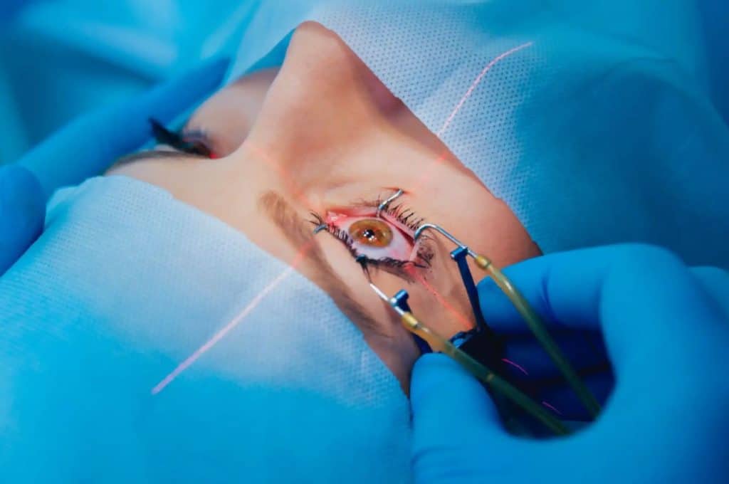Crystal Clear Vision: the Art and Science of Lasik Surgery