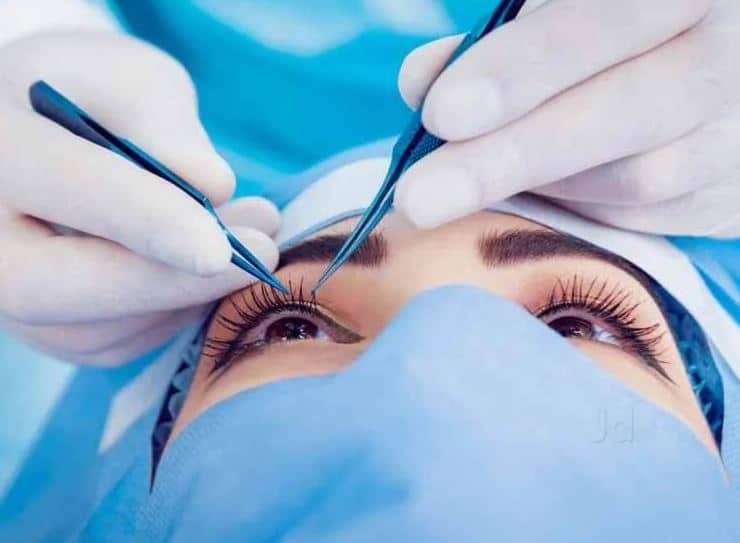 Eyes Wide Adventures: Exploring the World Through Lasik Lenses