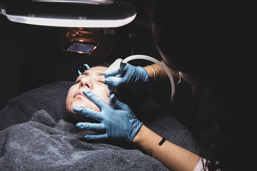 Lasik Procedure