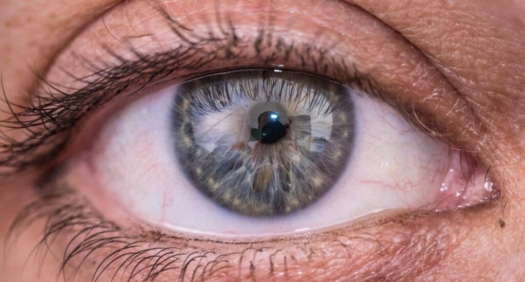 Photo Lasik Eye Surgery