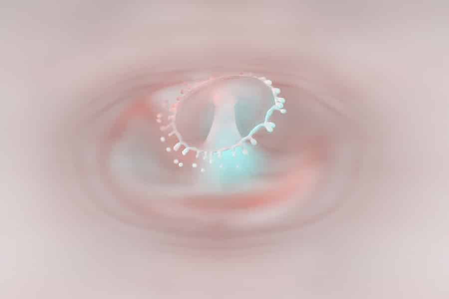 Photo Lasik Eye Surgeon