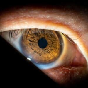 Photo Laser Eye Surgery