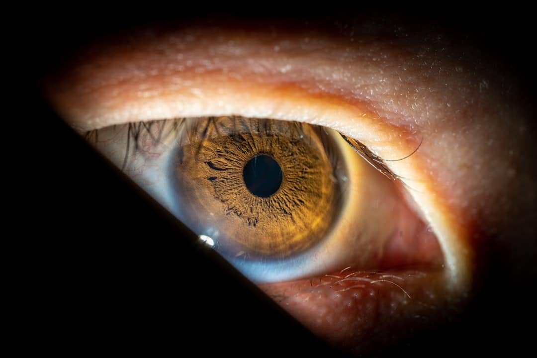 Photo Laser Eye Surgery