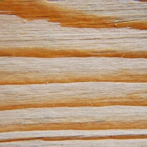 Photo Bladeless Lasik