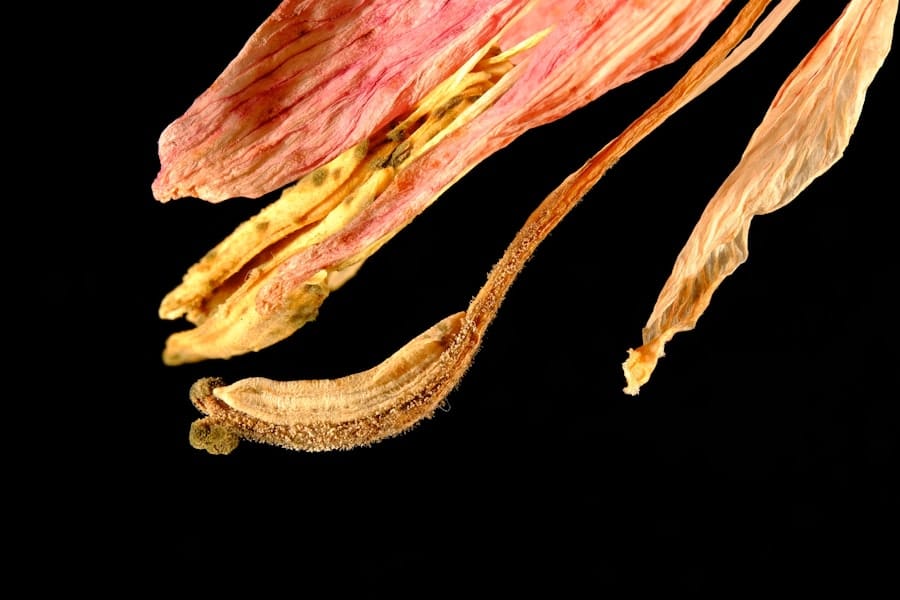 Photo Bladeless Lasik