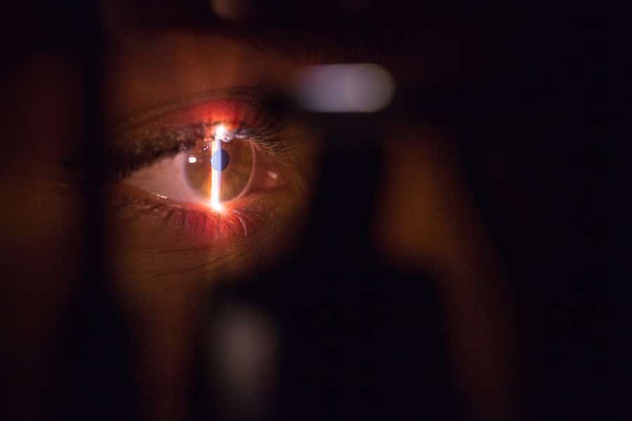 Photo Laser Vision Correction