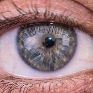 Photo Lasik Eye Surgery