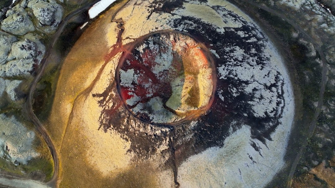 Photo Lasik Surgery